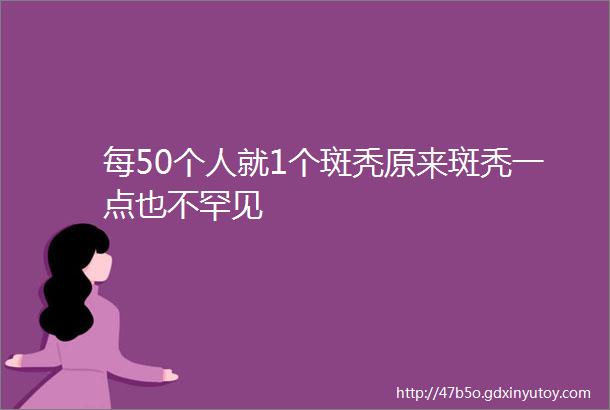 每50个人就1个斑秃原来斑秃一点也不罕见